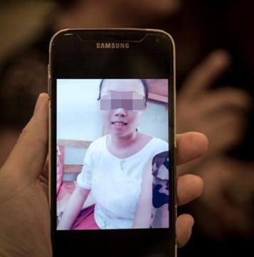 结缔组织病预兆,结缔组织病50岁死亡率高吗