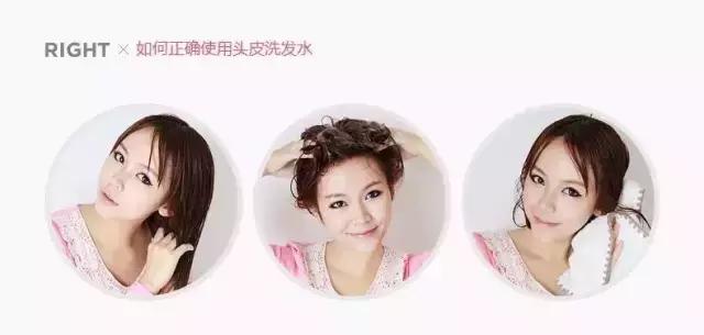 年轻小伙发际线后移用什么洗发水,7款超好用洗发水拯救你的发际线