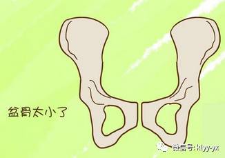 孕期检查结果准确率高吗,孕期查产道怎么查