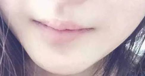 嘴唇上有几种颜色是什么病,嘴唇肿要警惕四种慢性病
