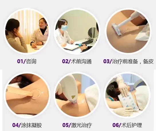 快上车，老司机教你什么才是这个季节的“*光脱**术”！