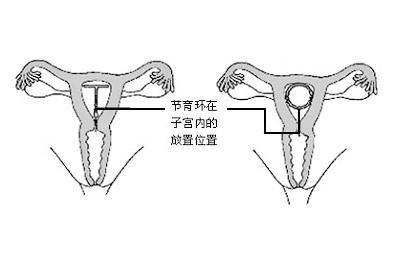 要“二孩”之前不得不引起重视的一件事
