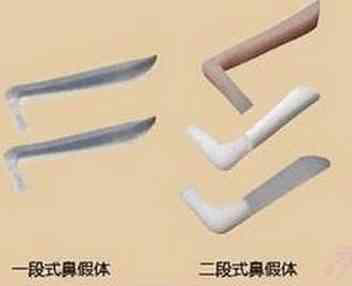 三段式假体隆鼻图片哪家好,进口隆鼻假体三段式