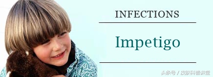 一张图教你辨别脓疱疮,皮肤科普直播