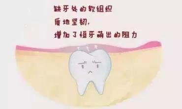 乳牙滞留的图片,下切牙乳牙滞留