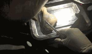 朋友圈内的整形工作室很恐怖，别再被坑了