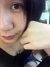 韩式三点双眼皮恢复单眼皮,韩式三点式双眼皮是永久性的吗