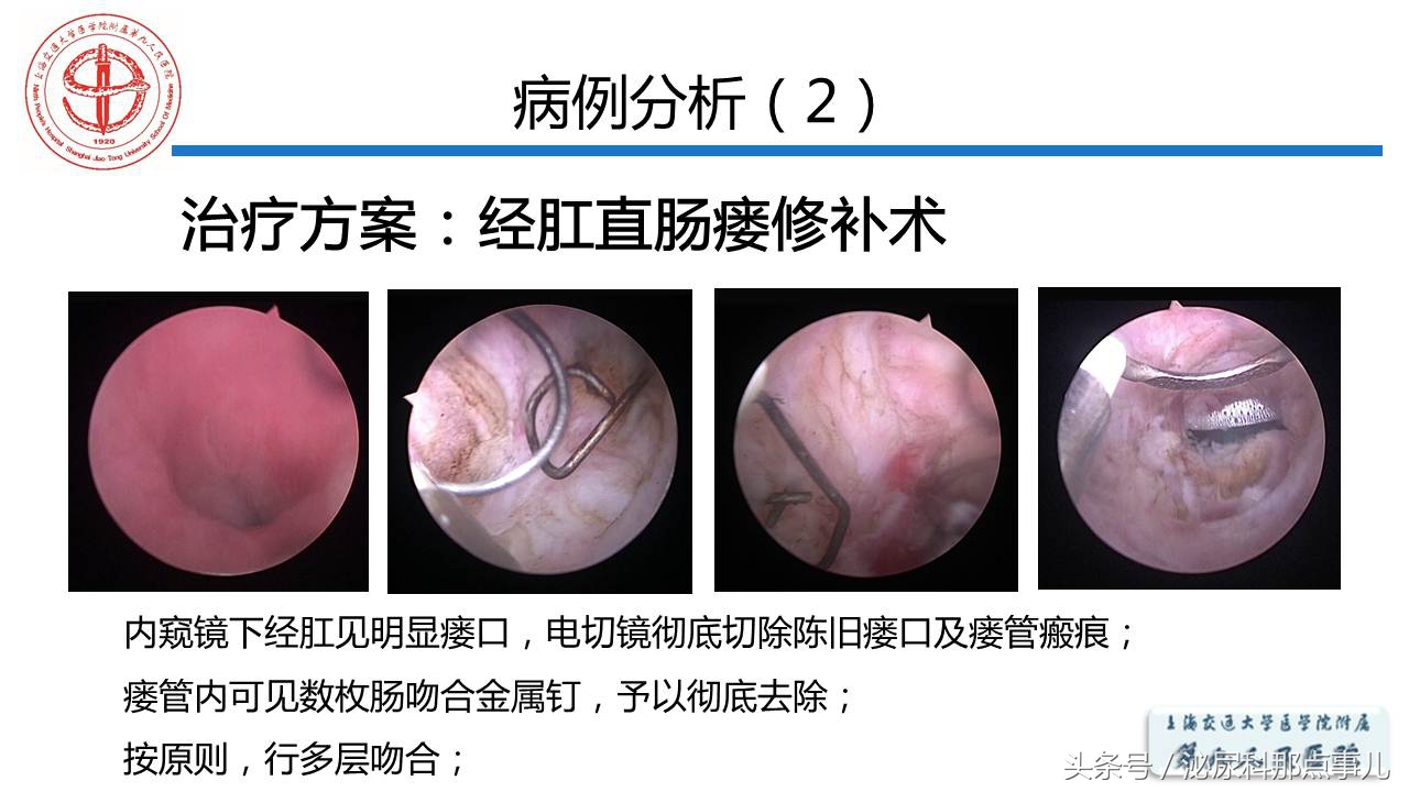 泌尿男科王忠教授,泌尿外科专家王忠教授