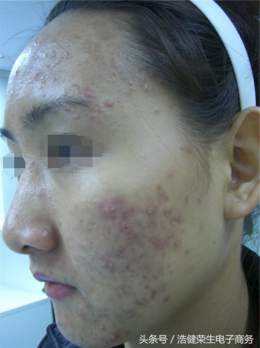 不要小看这些症状,不要小看你的疾病