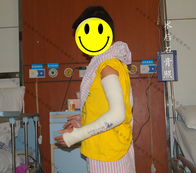 孩子胳膊摔伤后伸不直怎么办,小孩摔了跤胳膊伸不直是怎么回事