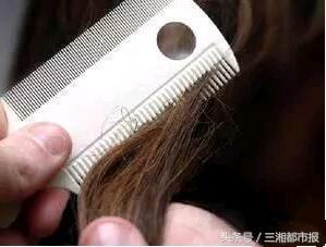 8岁女孩头皮痒老抓怎么办,8岁女孩子头皮特别痒有头皮屑