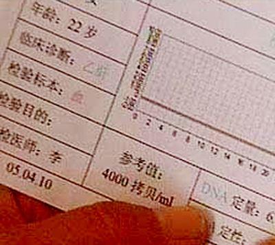 怎么看乙肝病毒检测报告,乙肝检测报告怎么看病毒数量