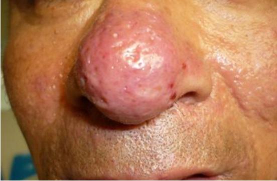 抽烟喝酒不良习惯,抽烟喝酒吃辣椒都是坏习惯