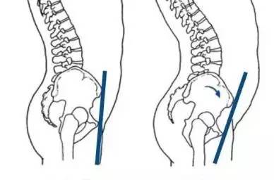 为啥有些女生很瘦却腿粗,为什么女生很瘦但腿很粗