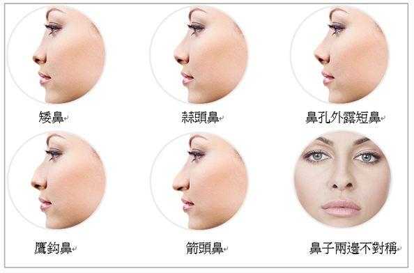 鼻子做假体隆鼻有什么坏处,隆鼻以后老了鼻子会怎样