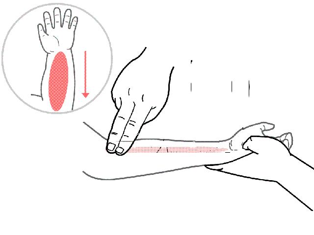 儿童扁桃体肥大切除手术后发烧,发烧引起扁桃体肿大要切除吗