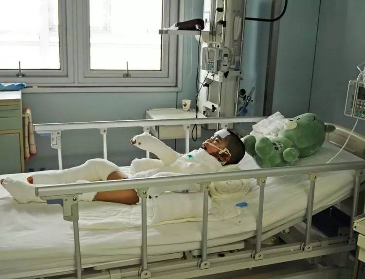 烫伤植皮男孩后续,好心人看望6岁烧伤男孩捐款10万元