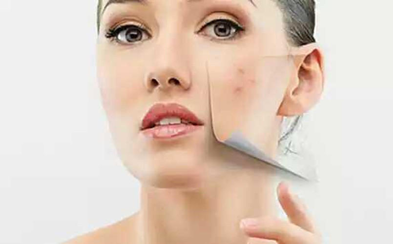 你为什么长痘出油,你还在为长痘痘而烦恼吗