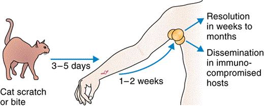 有没有被猫抓过,那你可要留意一下这个皮肤病了,猫抓病