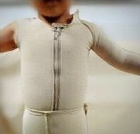 武汉治疗疤痕疙瘩哪家医院最好,疤痕疙瘩的手术治疗方法有哪些