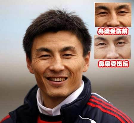 足坛名场面李玮锋,大头李玮锋简历