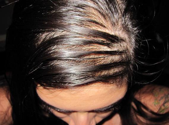 针对干枯头发的护发产品,头发可以顺直的护发产品