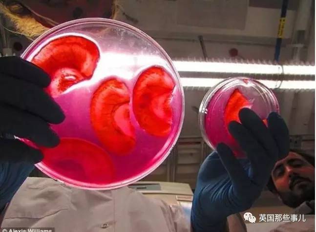 在苹果片上“种”出人耳？！这不是恐怖故事，是脑洞大开的医学新方向啊喂！