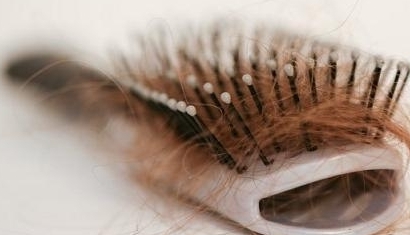 年轻人脱发的原因有什么食疗办法,年轻人脱发有白头发是什么原因