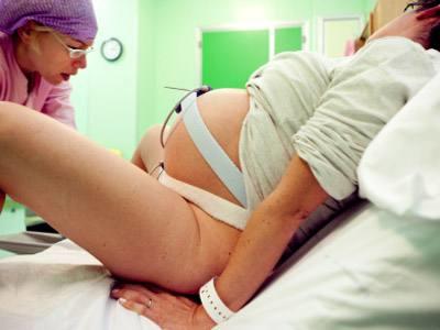 顺产侧切会影响什么,顺产侧切有影响吗