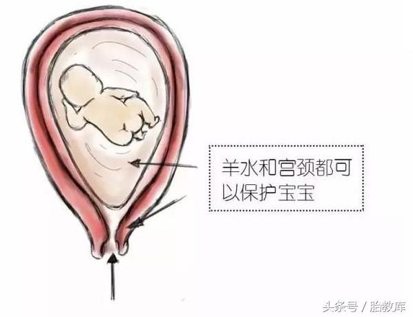 怀孕30周还能做无创吗,怀孕了还能做美容吗