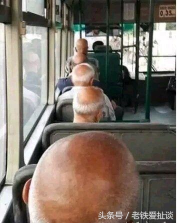 抽脂后胖了凹凸不平,严重抽脂减肥后图片