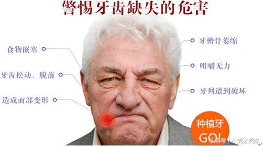 老年人镶牙的类型和价格,老年人镶牙选哪种好