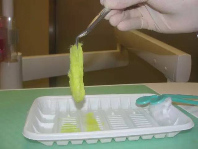 上火引起嘴唇干裂起皮用啥药,因为上火嘴唇起皮吃什么药