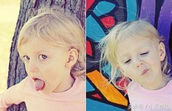 孩子眨眼耸鼻撅嘴一定是抽动症吗,男童抽动症噘嘴眨眼推拿手法