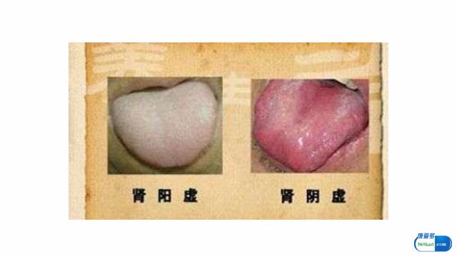 肾阴虚和肾阳虚最简单的辨别方法,怎么正确判断肾阴虚还是肾阳虚