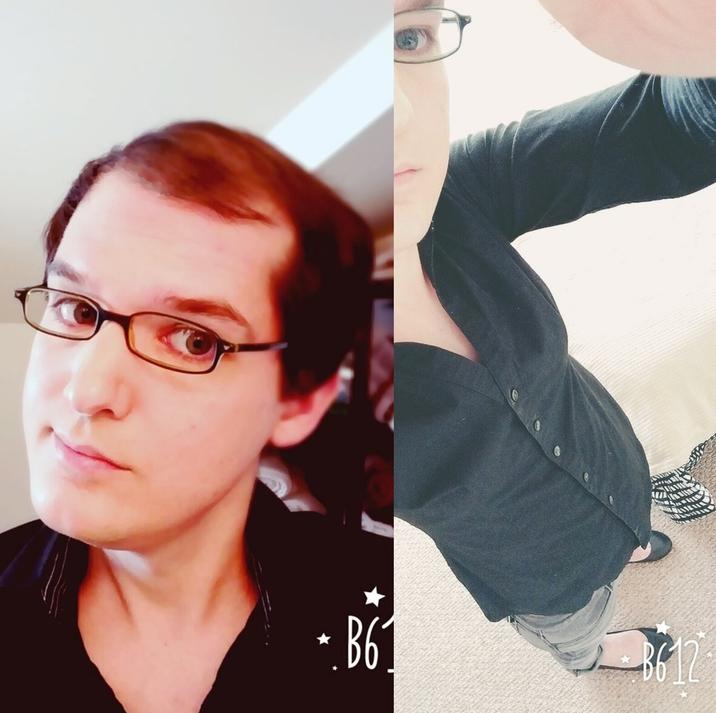 厉害了word的雌性激素，竟然还能拯救大叔的秃顶