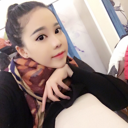 全切双眼皮疤痕增生多久可以恢复,全切双眼皮恢复过程经历真实