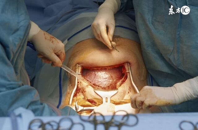 生孩子顺产内检,当接生遇到前男友