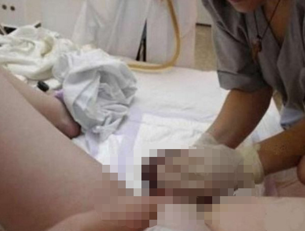 生孩子顺产是从屁股里出来吗,生孩子顺产发现胎儿是横着的