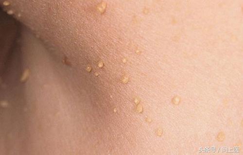 人常见的皮肤病,十二种最常见的皮肤问题对照图