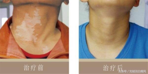 不要自己吓自己的图片,不要自己吓自己人生感悟