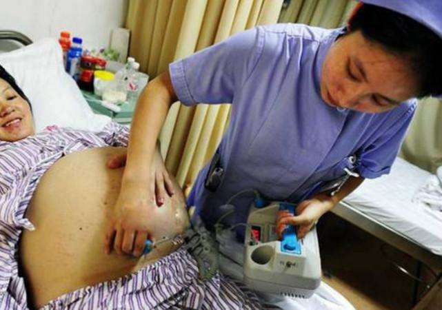 “剖腹”产子，是否也要等到见红、破水、肚子疼