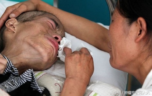 癌症20天不吃饭只喝水能活多久,87岁得癌症活多久不吃饭