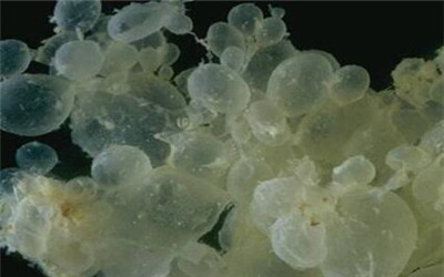 孕期出血真的是要流产了？孕期出血怎么一回事，孩子还能保住吗？