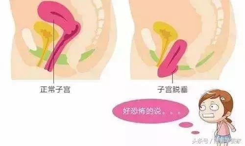 怀孕后期压力很大后悔了怎么办,怀孕后必知的8个真相