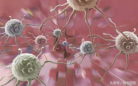 风湿滑膜炎怎么治疗最有效,自述髋关节滑膜炎康复经历