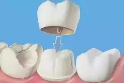 有多少明星整了鼻子,整过的明星有哪些