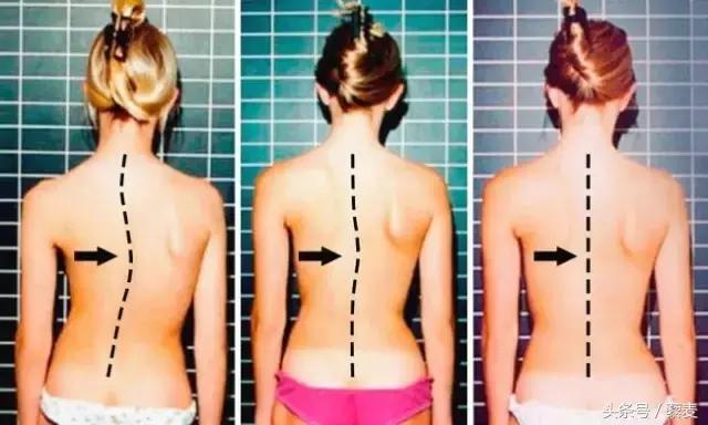 腰痛脊柱痛的最好解决办法,整天腰痛