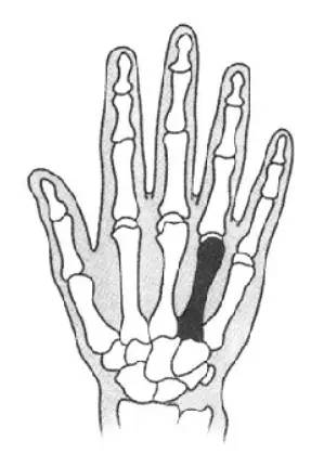 臀腰寒凉怎么治,臀腿凉怎么办