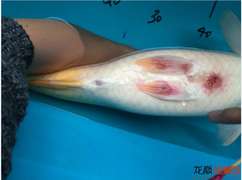 疖子的最佳治疗方法,疖子疮怎么治疗